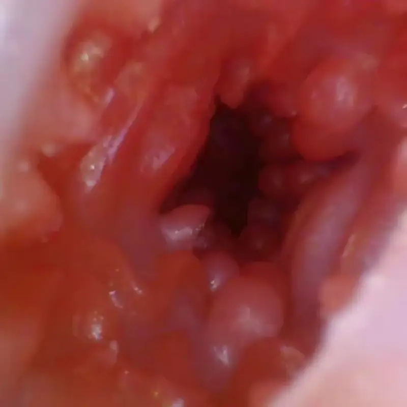 🐠 Fish Fleshlight Double-Channel Fleshlight – 4.92in & 4.33in Silicone Fish Masturbator with Textured Spikes